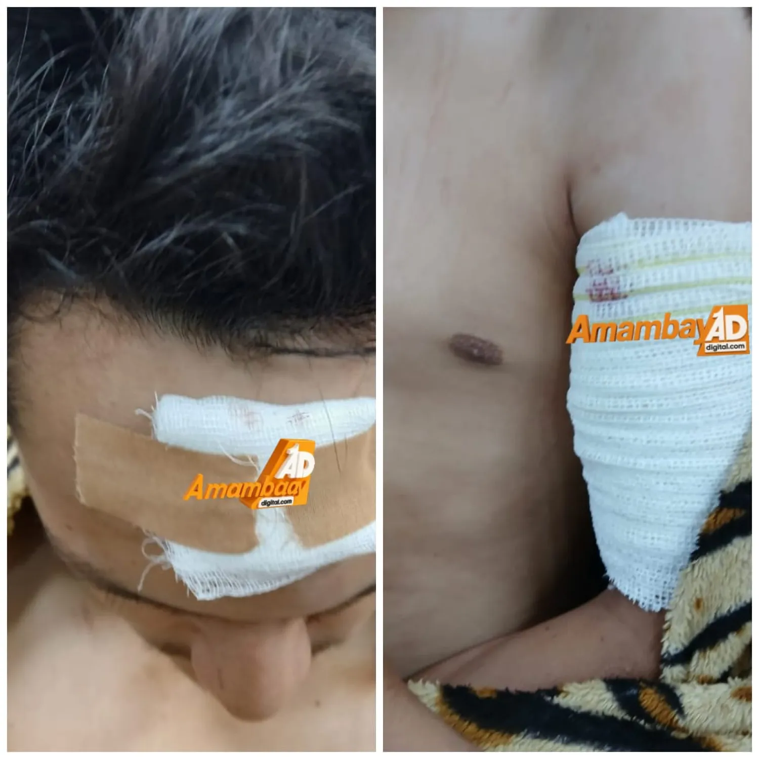 Intentan robar una motocicleta y hieren al dueño de casa en Pedro Juan Caballero