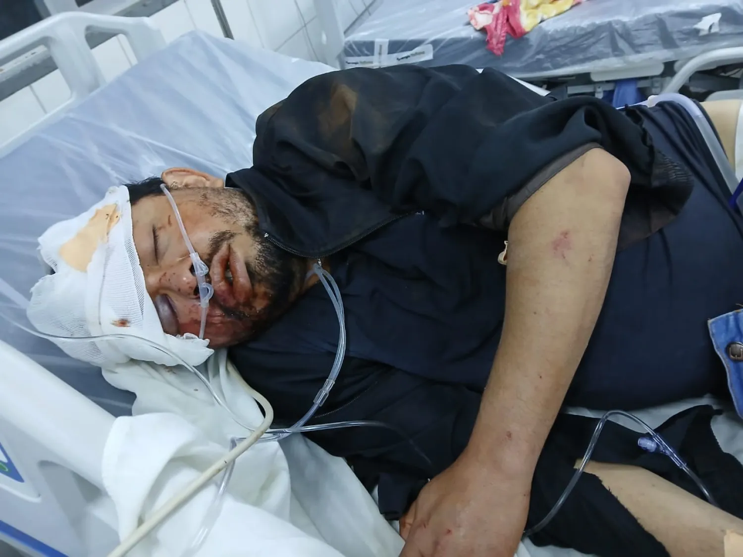 Grave accidente en Cerro Kuatia