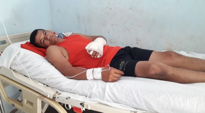Cebollón tampoco es juego de adultos: "Yo quería tirar y explotó por mi mano"