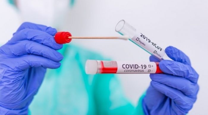 Confirman 159 nuevos casos de COVID-19, con casi 60 sin nexo