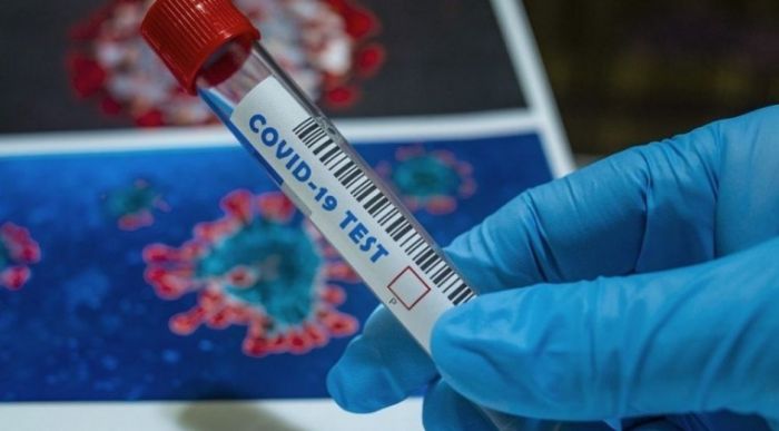 Paraguay alcanza los 77.000 casos de COVID-19, con 596 nuevos contagios y 8 decesos