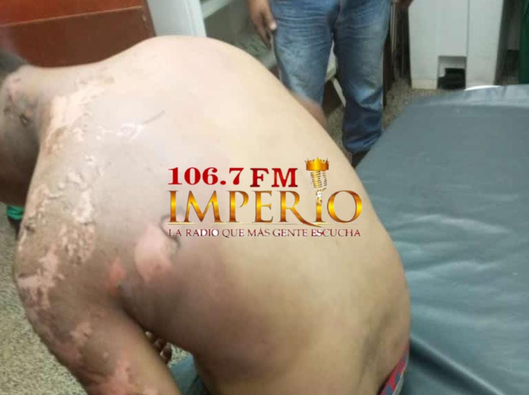 Joven sufre descarga eléctrica mientras trabajaba