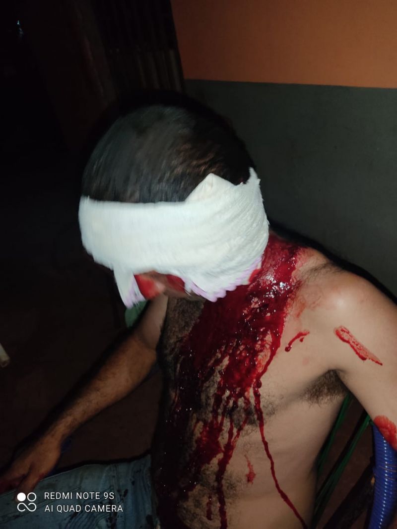 Por no comprar más cervezas, hombre fue herido en la cabeza por su compañero de tragos