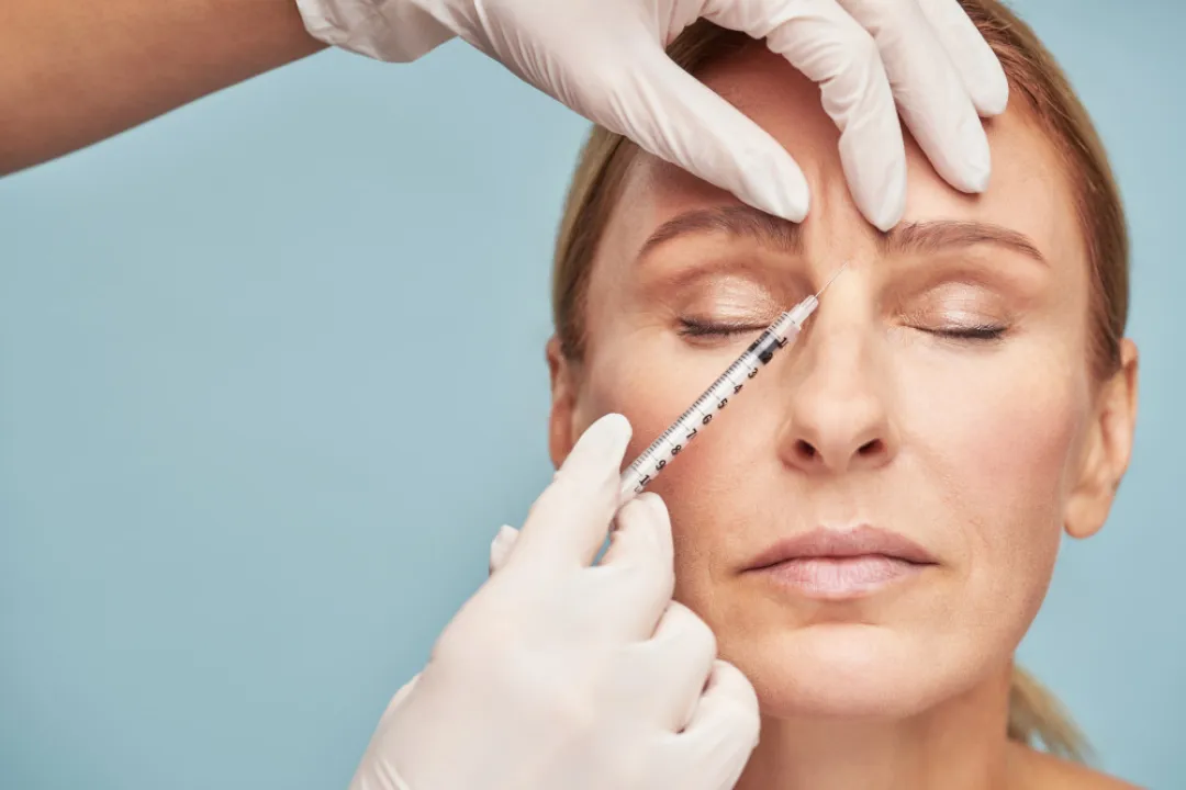 Uso de bótox, estética con fecha de vencimiento