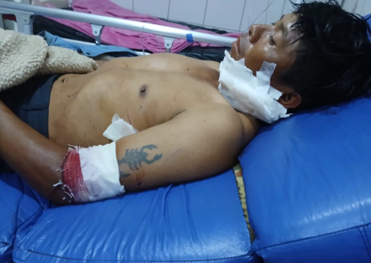Indígena es herido de gravedad con un machetillo en Capitán Bado