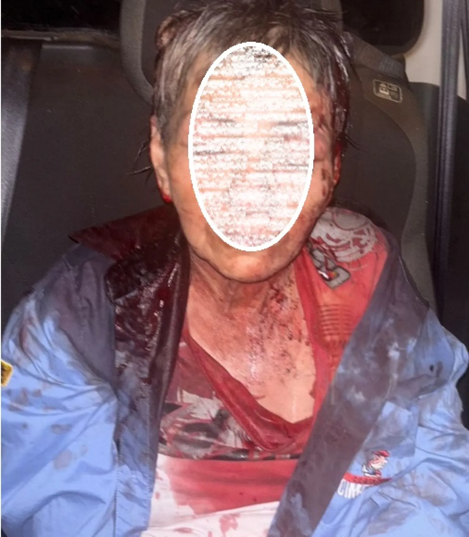 Una mujer de 57 años resultó herida tras un ataque grupal en el barrio Jardín Aurora