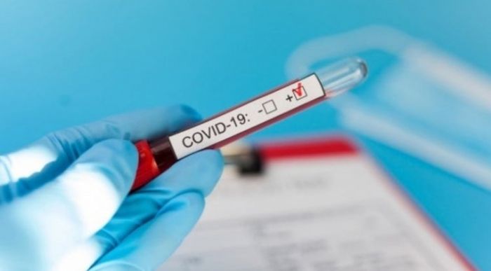 Elaboran "árbol epidemiológico" para rastrear a personas que tuvieron contacto con militar con COVID-19