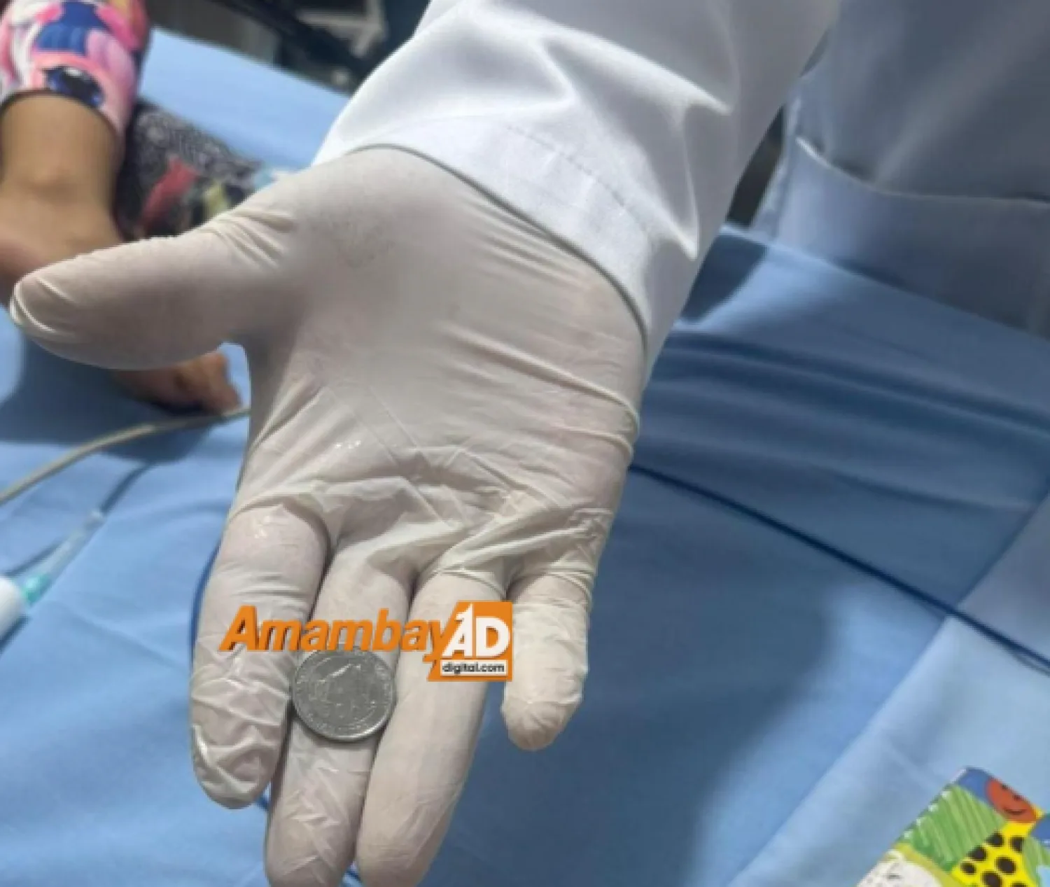 Extraen con éxito una moneda del estómago de una criatura mediante endoscopía de urgencia