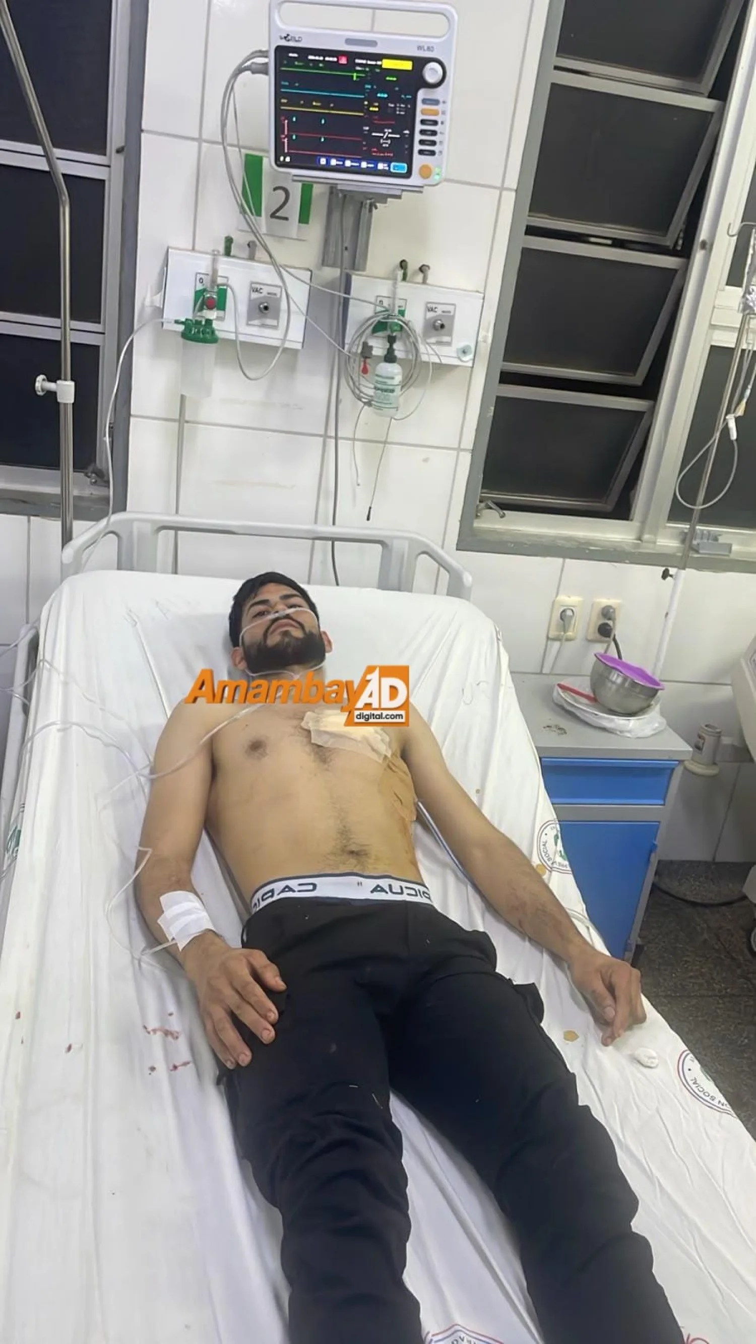 Cuidador de un Bar fue herido con arma blanca y permanece hospitalizado