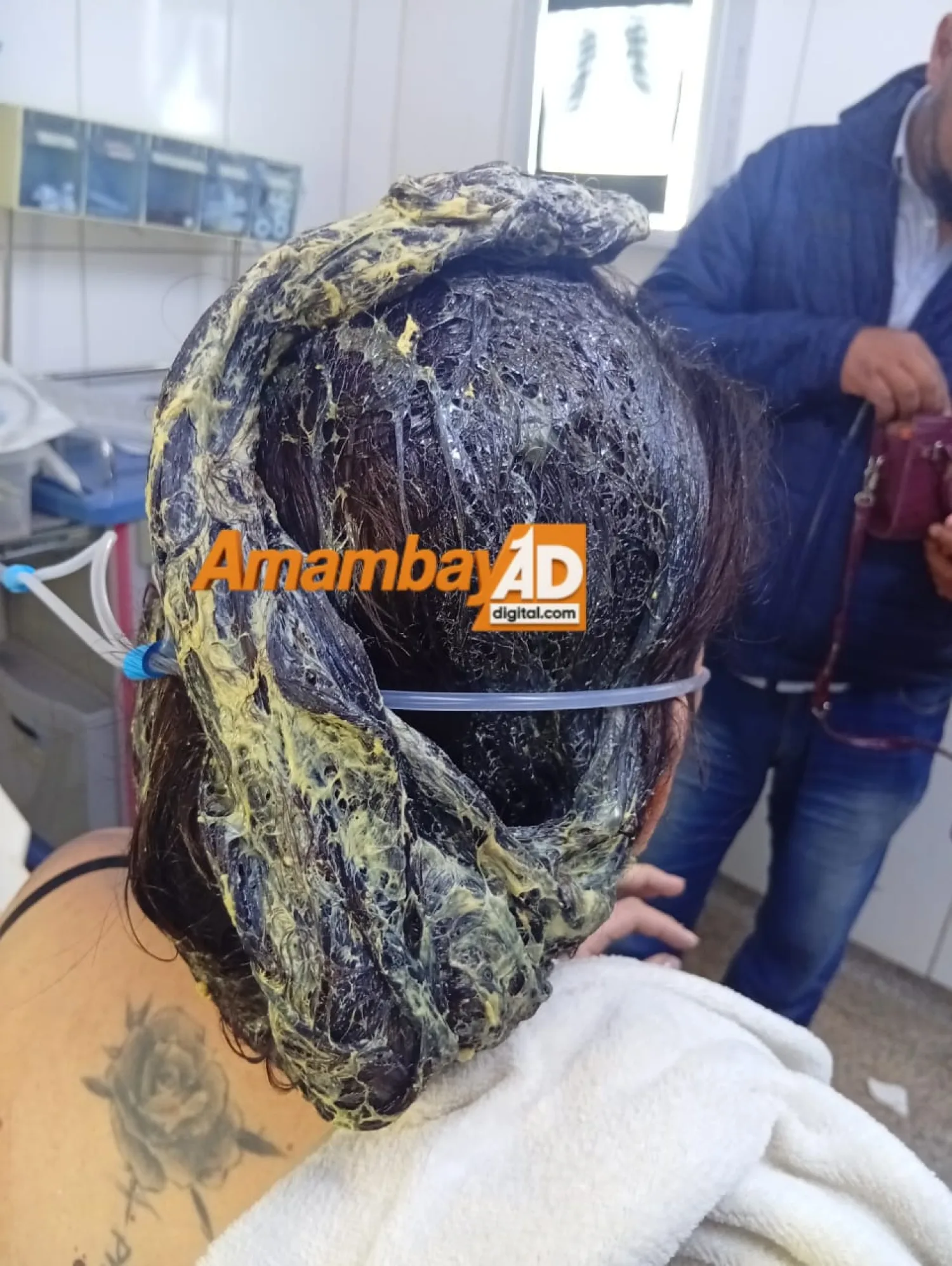 Mujer denuncia que fue golpeada por su pareja y que le arrojó cola de zapatero en plena vía pública