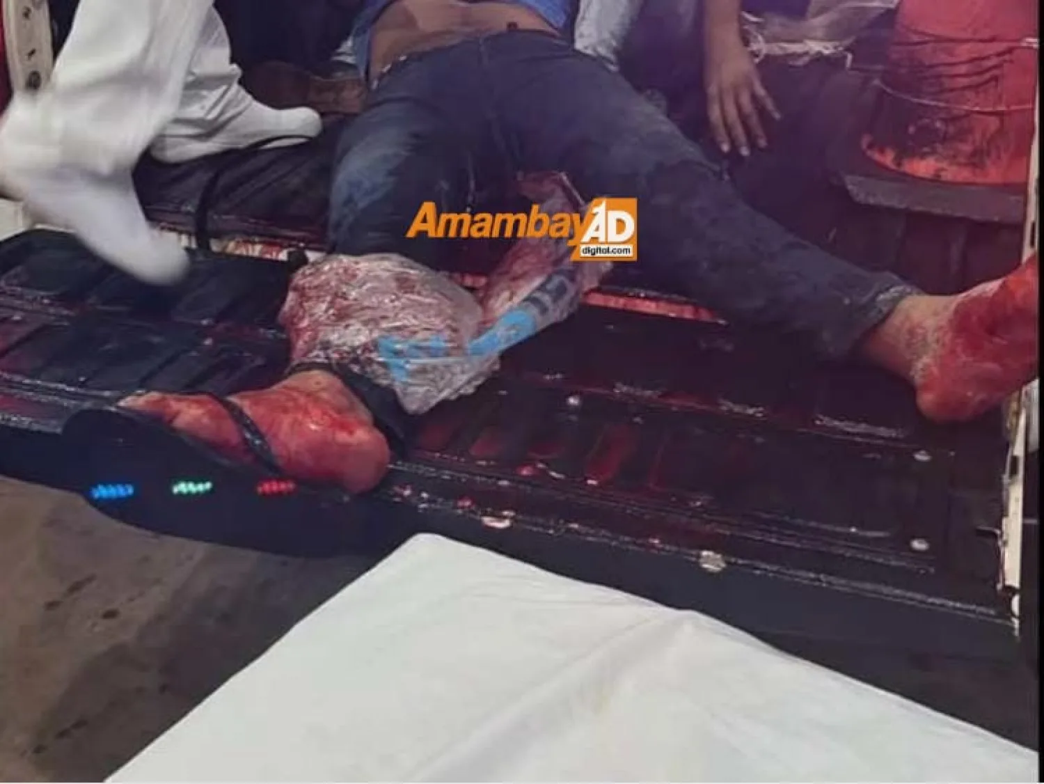 Fatal accidente doméstico en PJC: una mesa de vidrio se rompe y provoca la muerte de un hombre, tras sufrir grave herida en la pierna