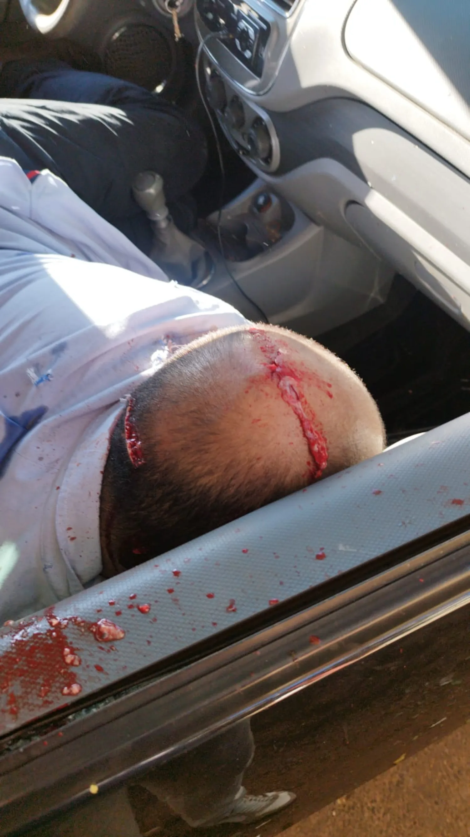 Asesinan a tiros a un hombre dentro de un vehículo en la zona del Hemocentro de Ponta Porã