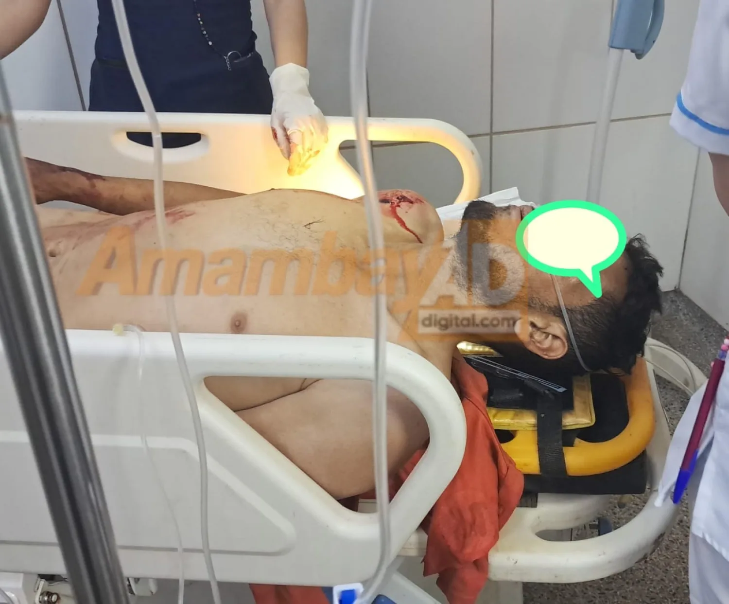 Joven de 25 años fue atacado a balazos en la zona de Potrero Sur