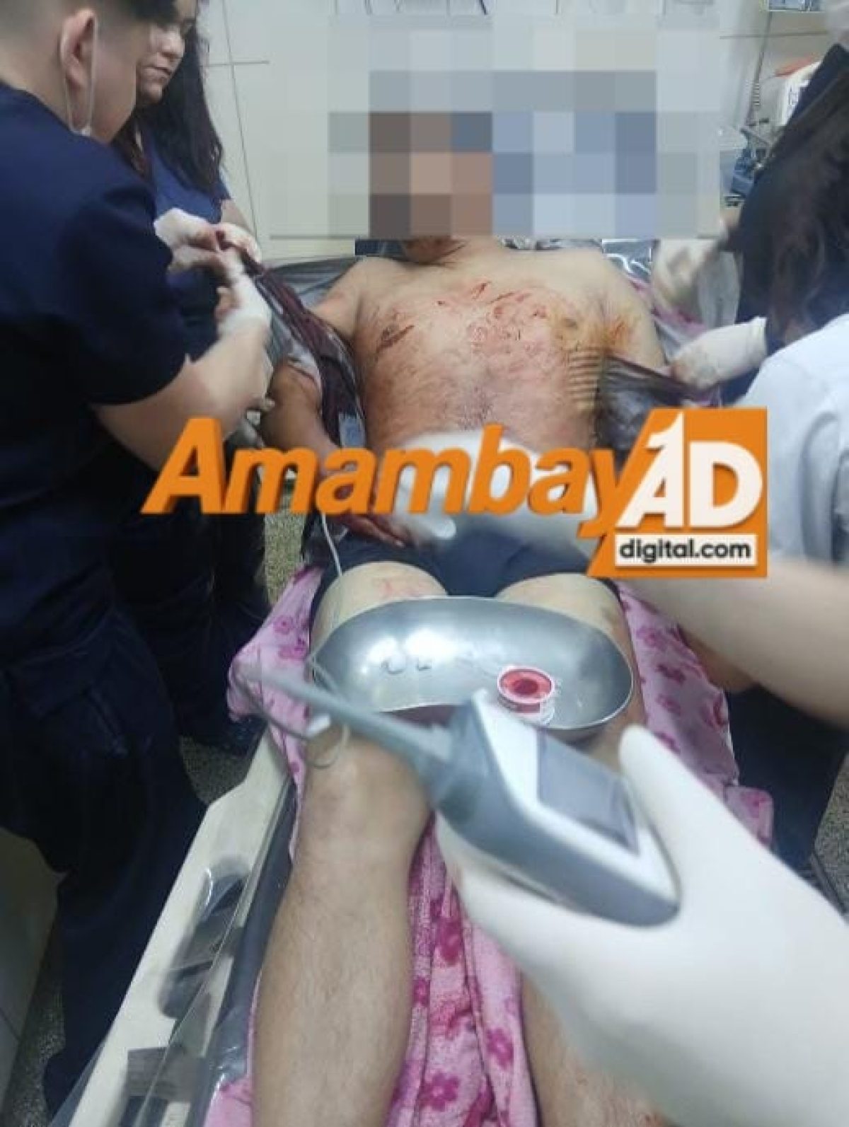 Ataque con cuchillo deja a un hombre con graves heridas en la Fracción Reyes Católicos
