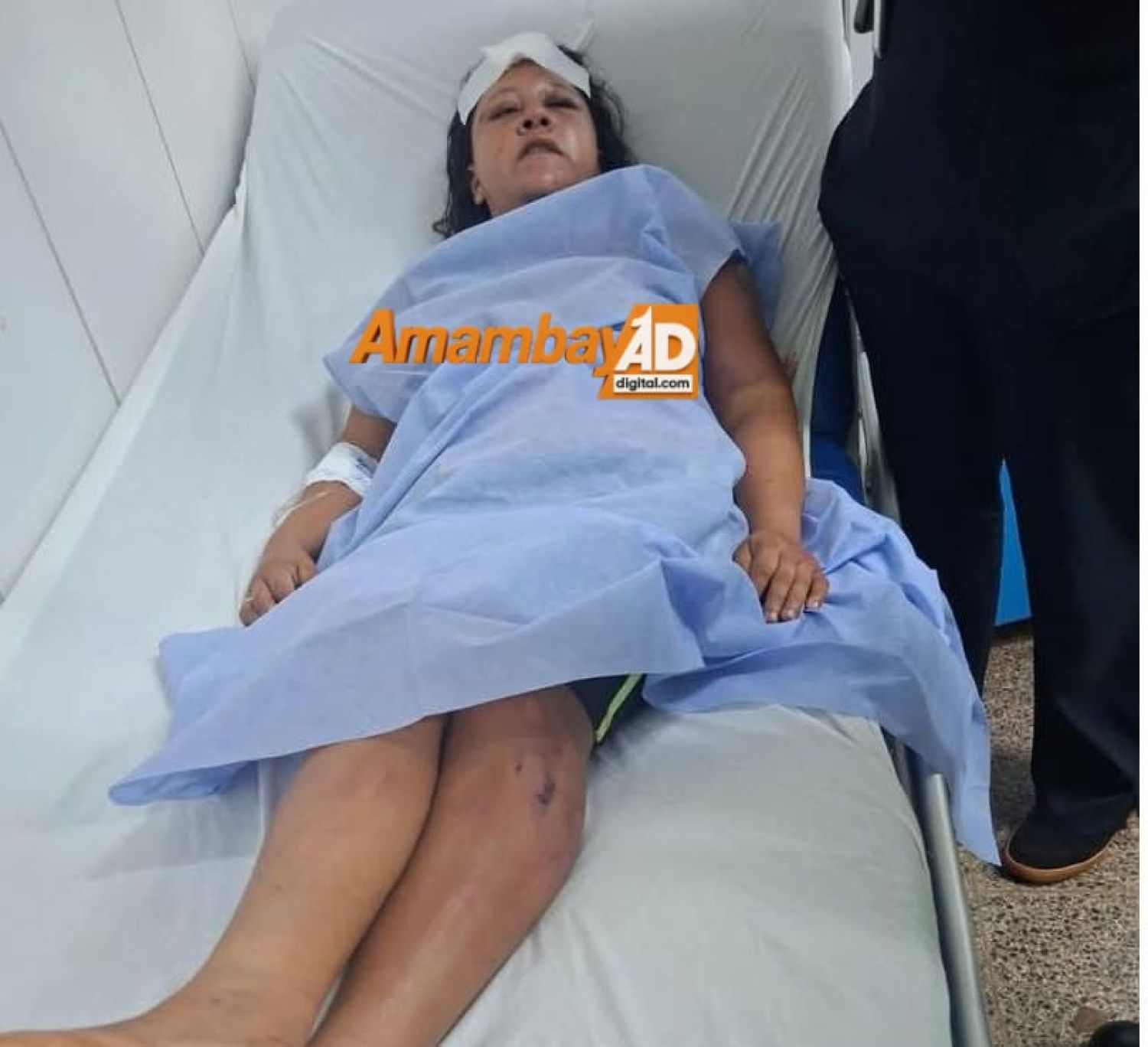 Paraguaya escapó de brutal agresión de su pareja en Ponta Porã y fue internada en el Hospital Regional de PJC